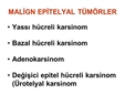 Malign Epitelyal Tümör Malign Epitelyal Tümör